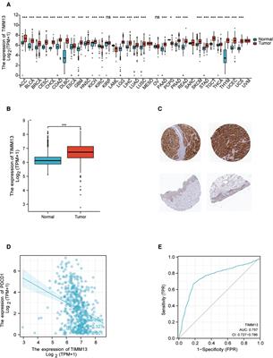 TIMM13 as a prognostic biomarker and associated with immune infiltration in skin cutaneous melanoma (SKCM)